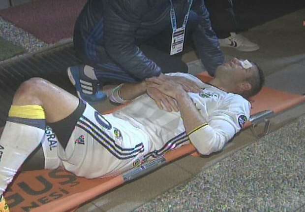 robin-van-persie-eye-injury-hp-size_zu6ag7n8rez51bc1f9hzl90av